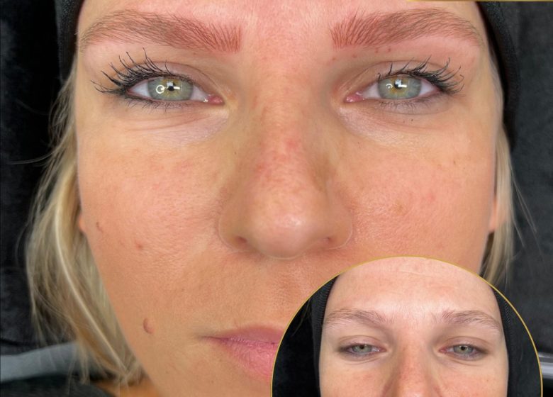 Pilar Mille Micropigmentation